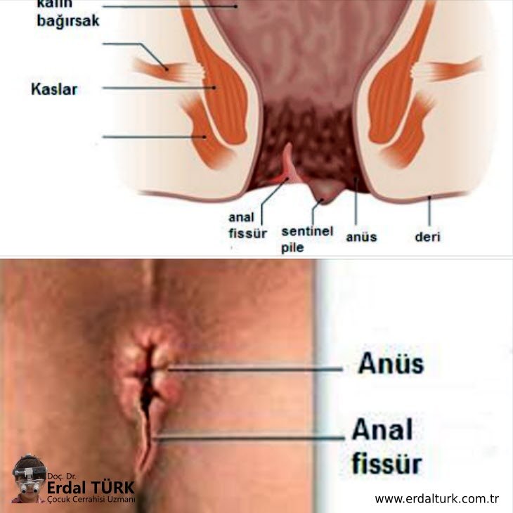 olgun kadn boalma beybi şa